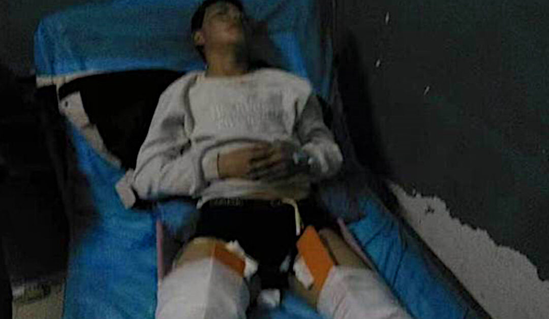 Dadul Broken Legs 1200×628 Free Tibet